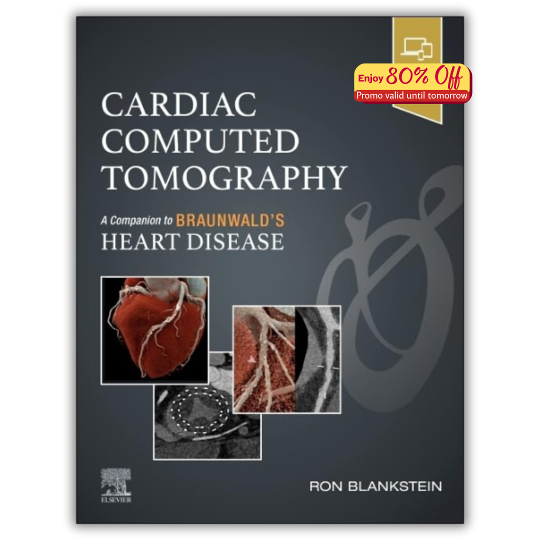 Cardiac Computed Tomography: A Companion to Braunwald’s Heart Disease (PDF)
