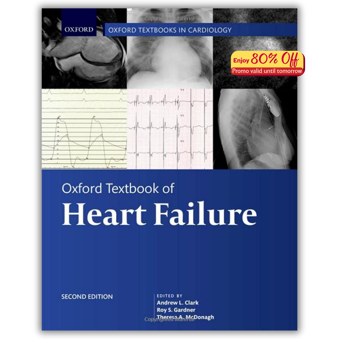 Oxford Textbook of Heart Failure, 2nd Edition (Oxford Textbooks in Cardiology) (PDF)