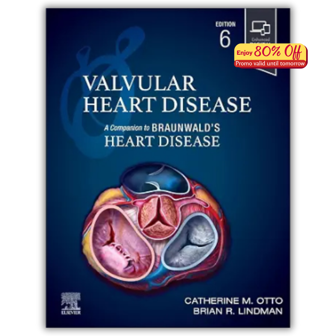 Valvular Heart Disease: A Companion to Braunwald’s Heart Disease, 6th edition (PDF)
