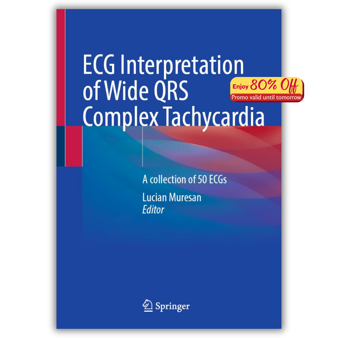ECG Interpretation of Wide QRS Complex Tachycardia (PDF)