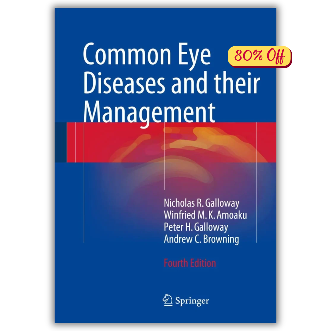 Common Eye Diseases and their Management, 4 Edition (PDF)