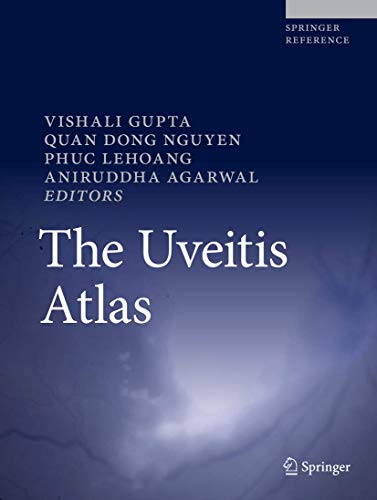 The Uveitis Atlas 1st Edition by Springer PDF