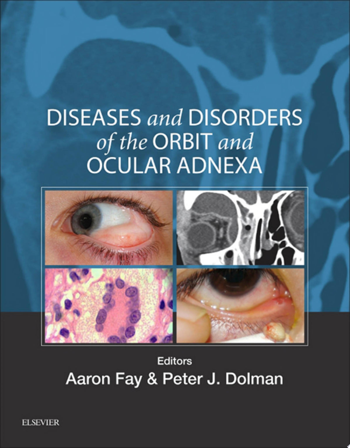 Eye Pathology: An Atlas and Text 2nd Edition by Lippincott Williams & Wilkins PDF