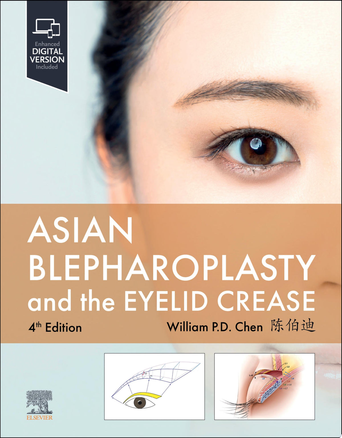 Asian Blepharoplasty and the Eyelid Crease 4th Edition by Elsevier PDF