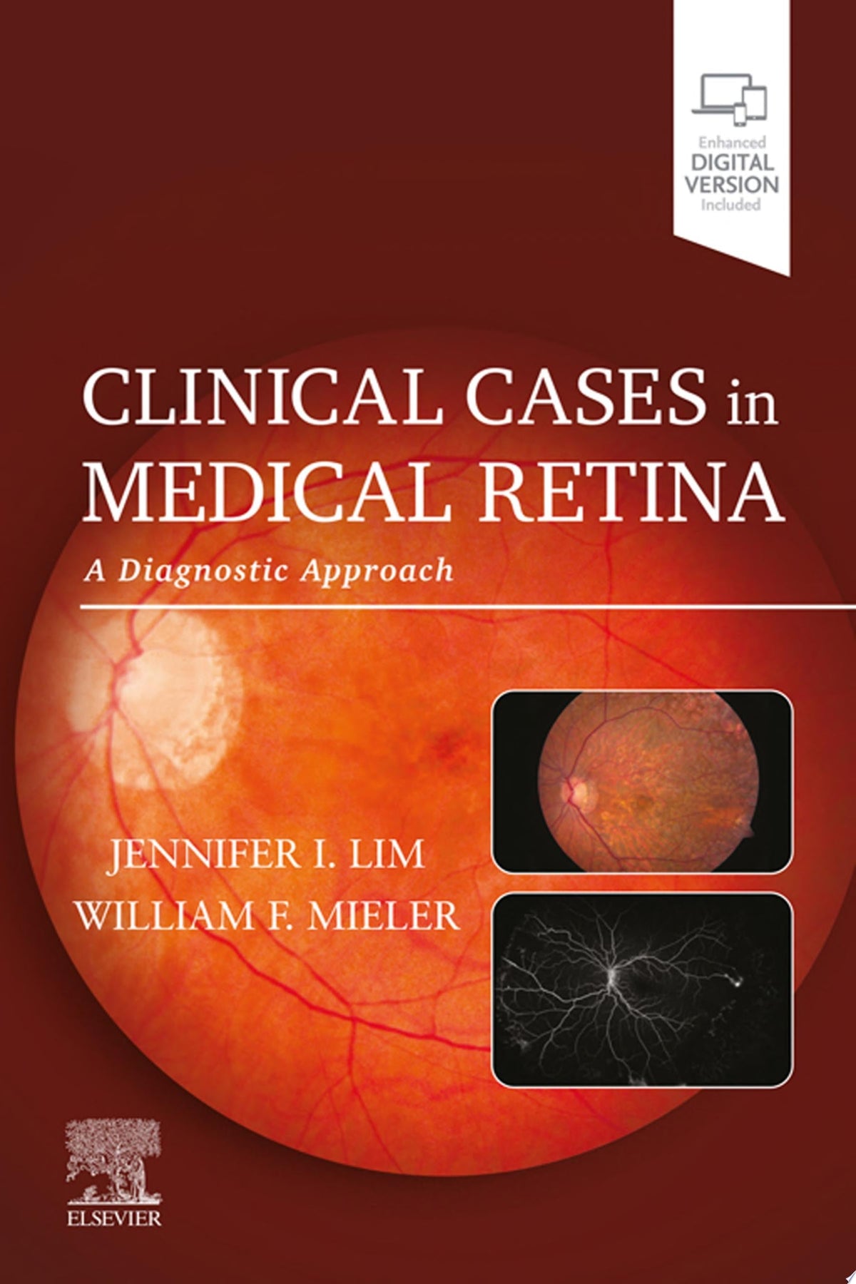Clinical Cases in Medical Retina 1st Edition by Elsevier PDF