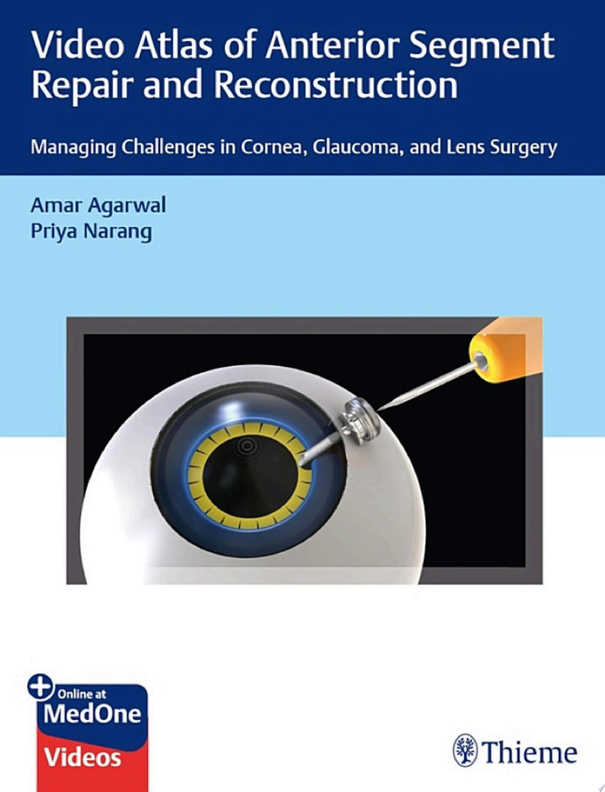 Video Atlas of Anterior Segment Repair and Reconstruction 1st Edition by Agarwal PDF
