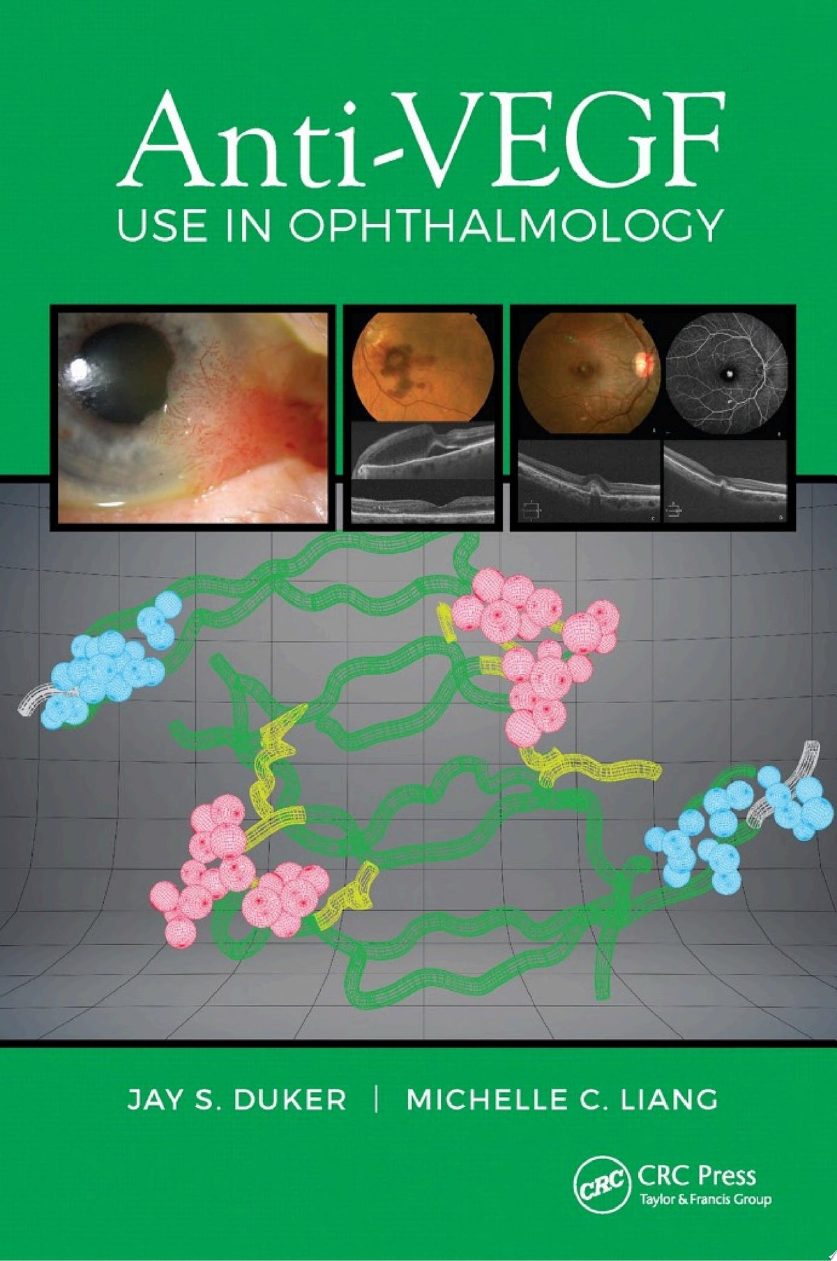 Anti-VEGF Use in Ophthalmology 1st Edition PDF