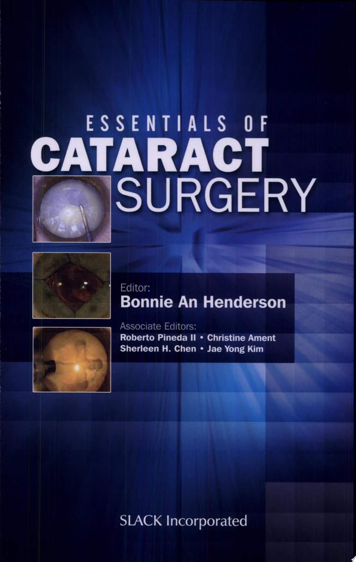Essentials of Cataract Surgery 2nd Edition by Bonnie An Henderson