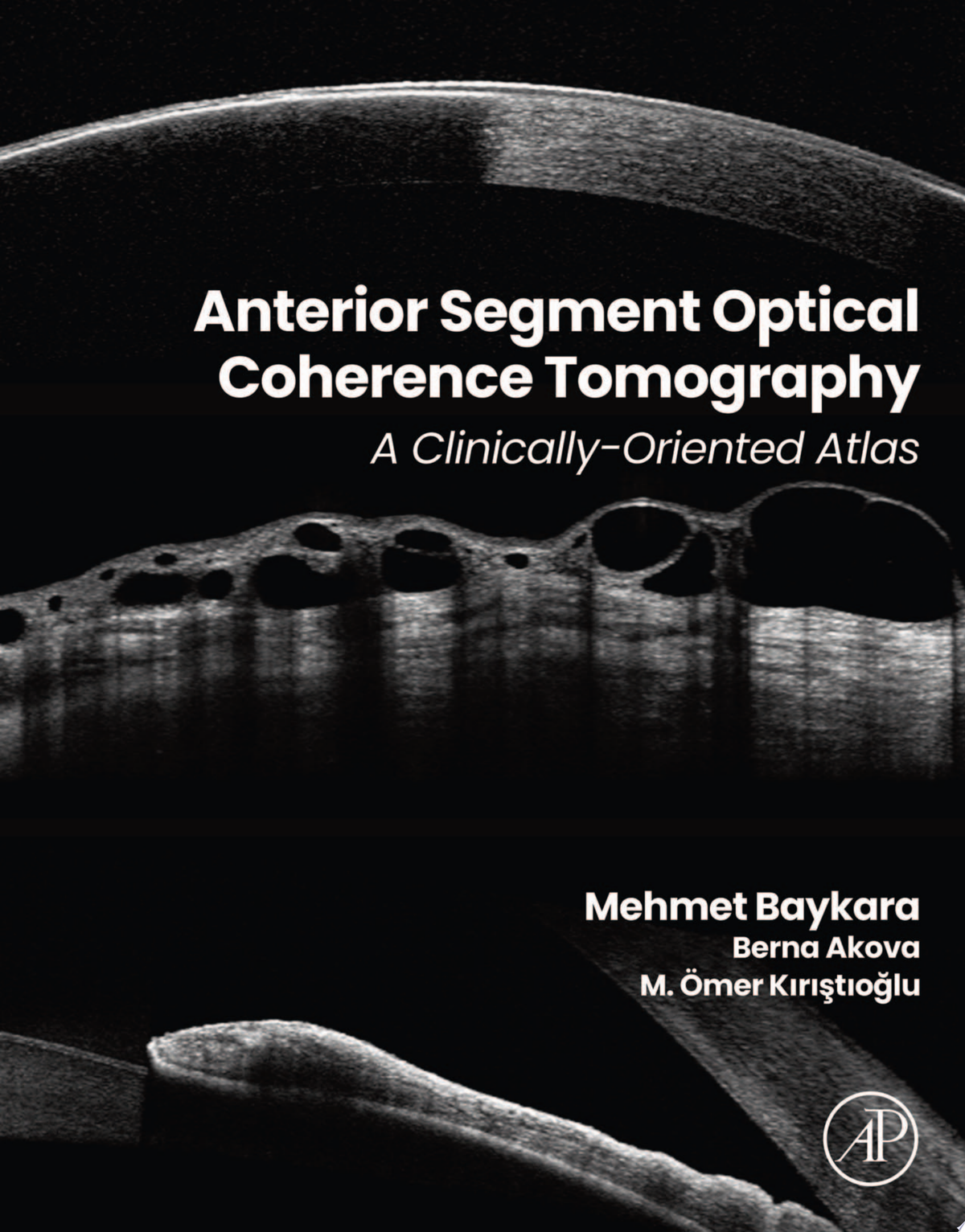 Anterior Segment Optical Coherence Tomography 1st Edition by Akova PDF