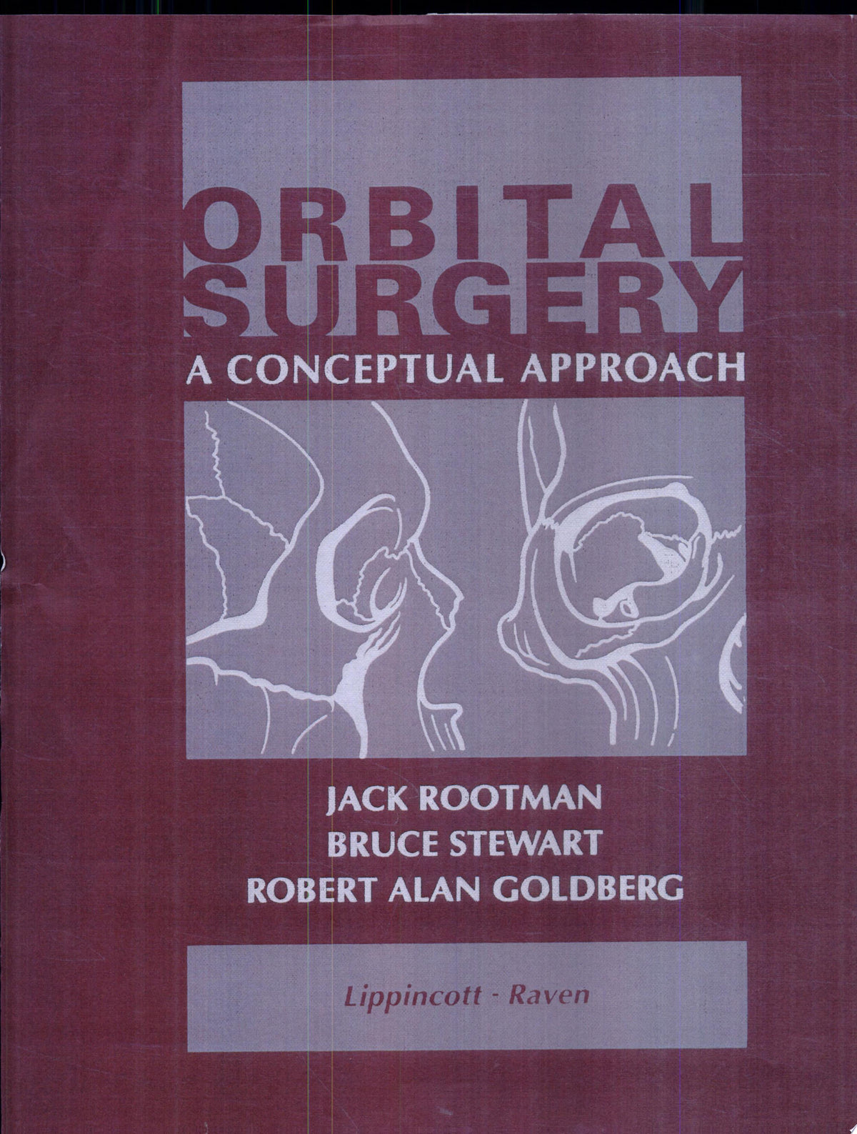 Orbital Surgery 1st Edition PDF