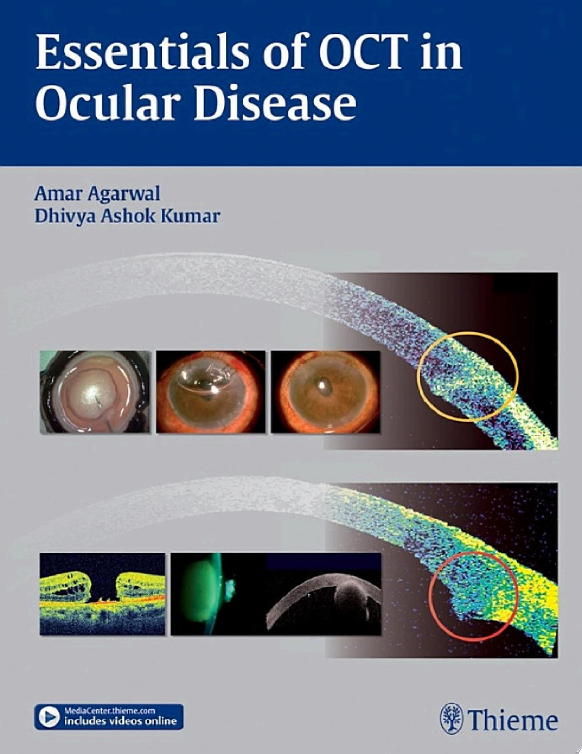 Essentials of OCT in Ocular Disease 1st Edition by Agarwal PDF