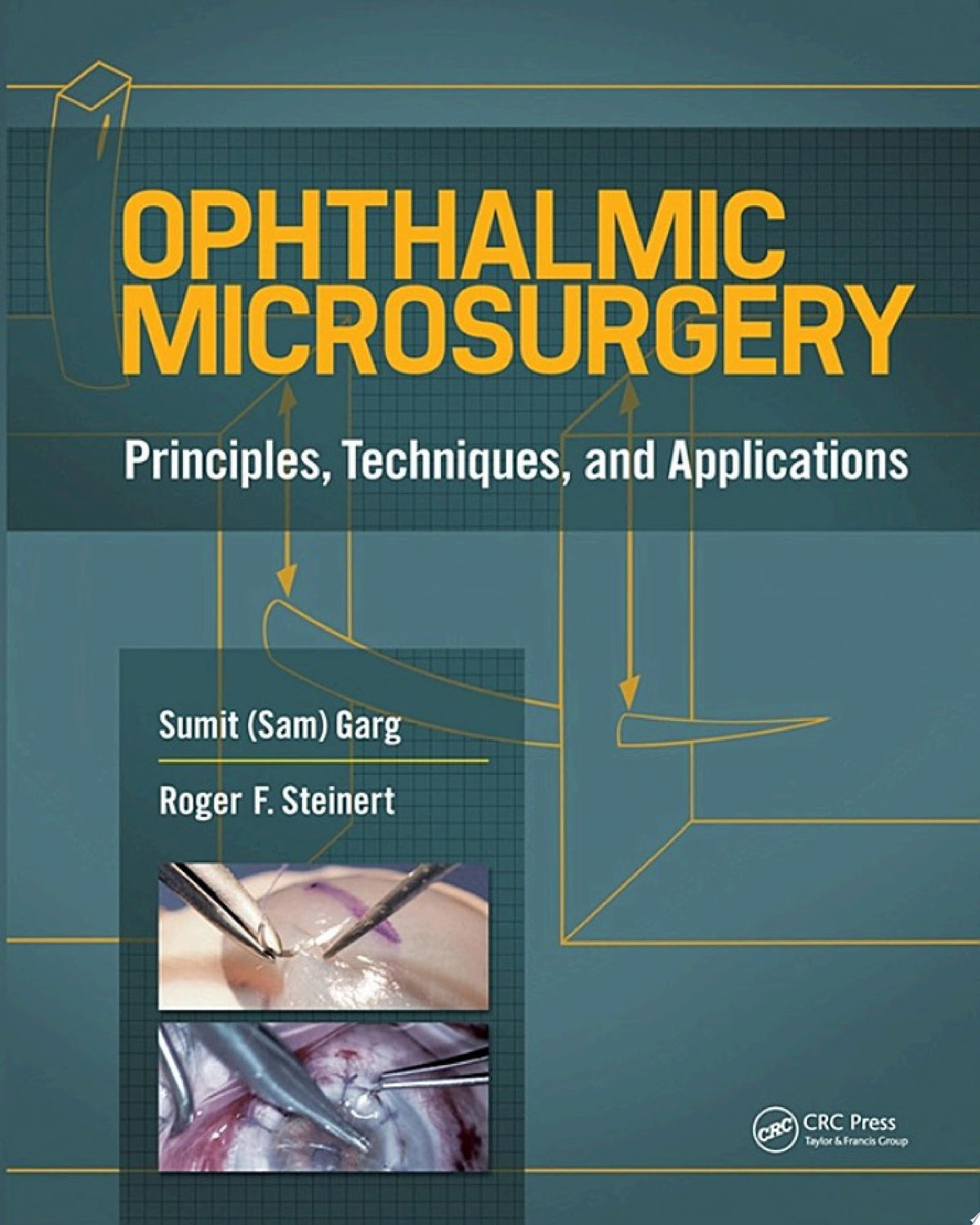 Ophthalmic Microsurgery 1st Edition by Slack Incorporated PDF