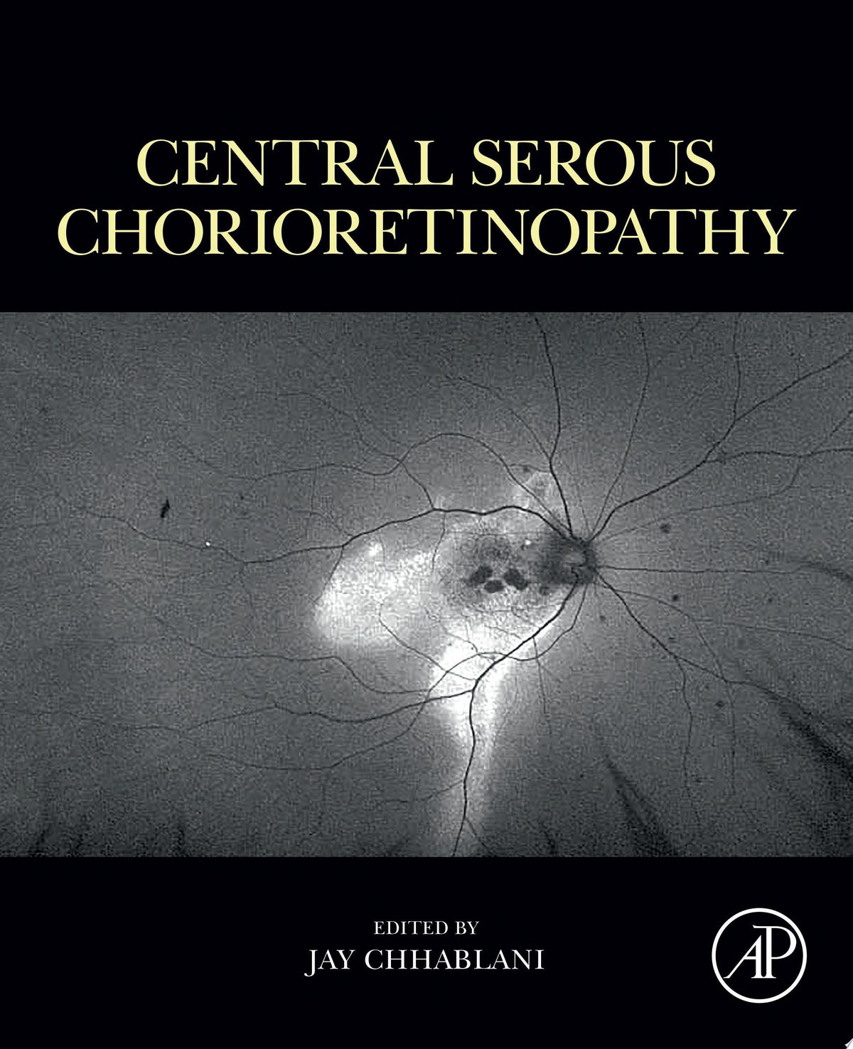 Central Serous Chorioretinopathy 1st Edition PDF