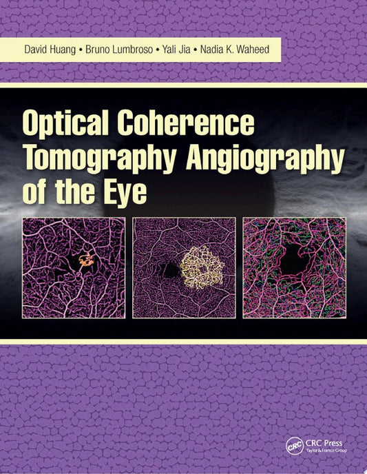Optical Coherence Tomography Angiography of the Eye 2nd Edition PDF