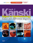 Signs in Ophthalmology Causes and Differential Diagnosis PDF