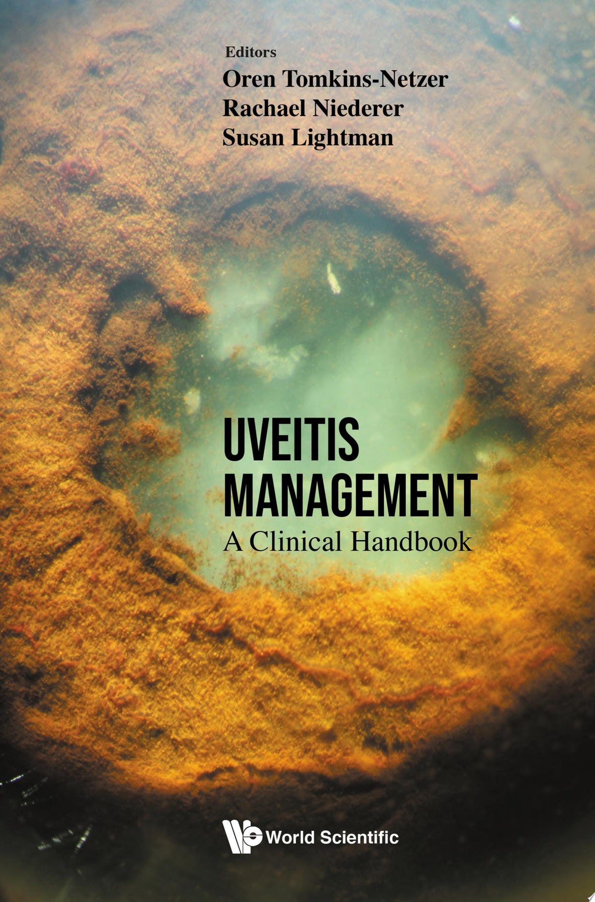 Uveitis Management: A Clinical Handbook 1st Edition PDF