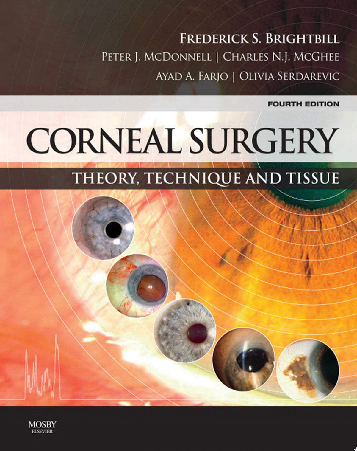 Corneal Surgery Theory Technique and Tissue 1st Edition by Brightbill PDF