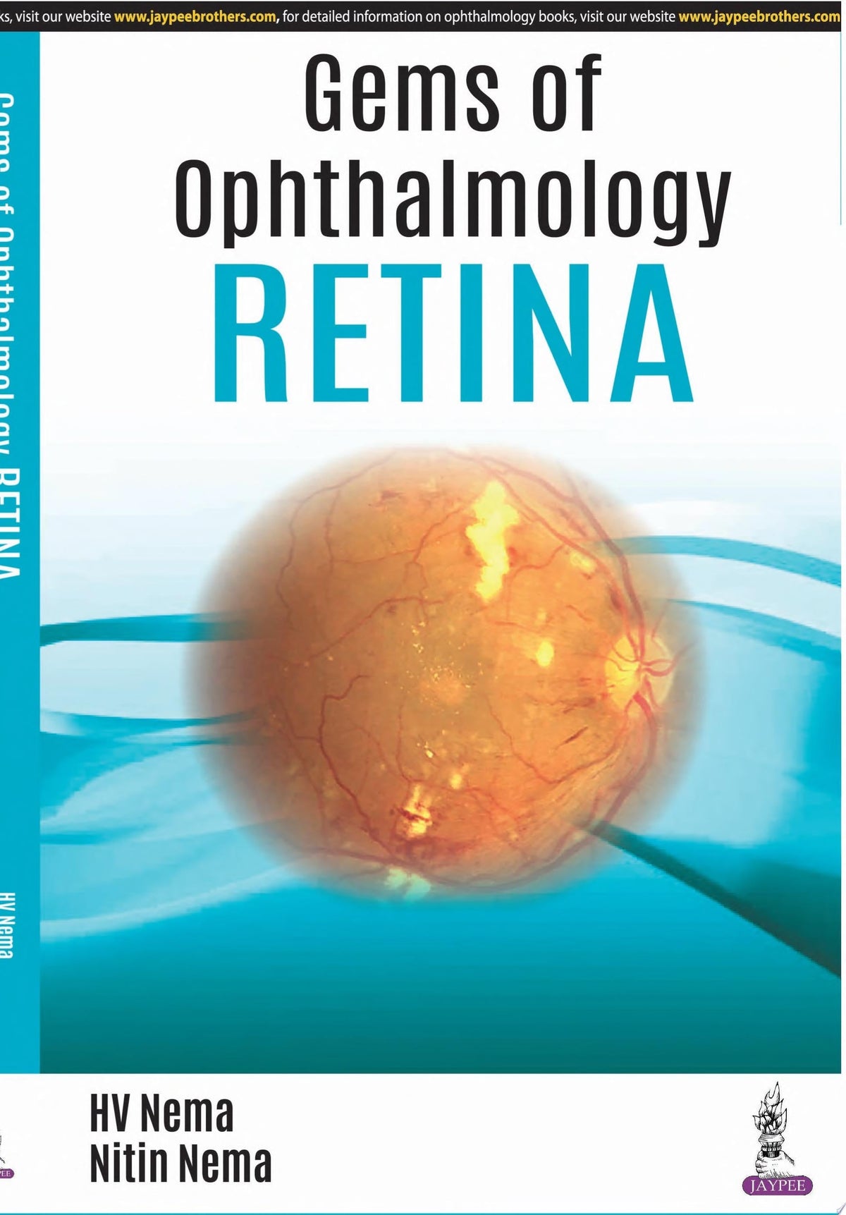 Gems of Ophthalmology: Retina 1st Edition by Jaypee PDF