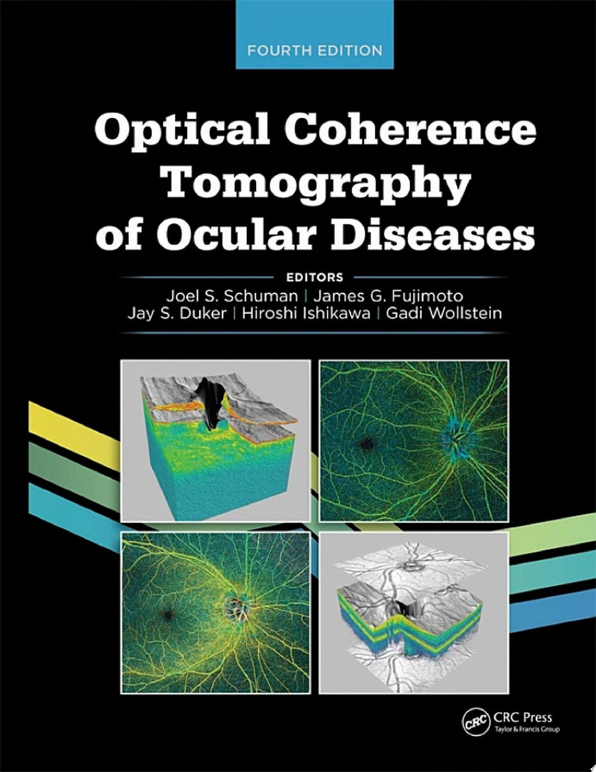 Optical Coherence Tomography of Ocular Diseases 1st Edition PDF