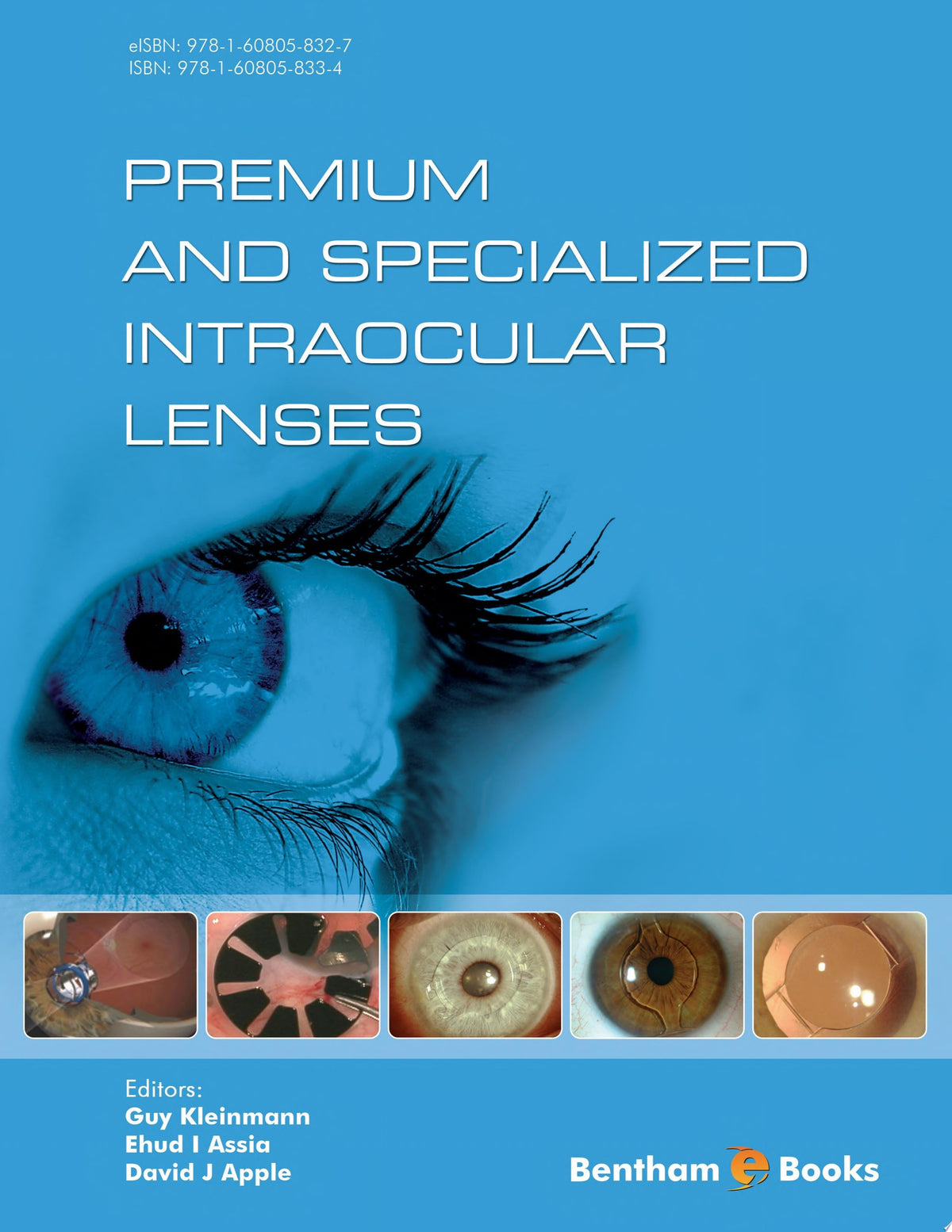 Premium and Specialized Intraocular Lenses 1st Edition by Assia PDF