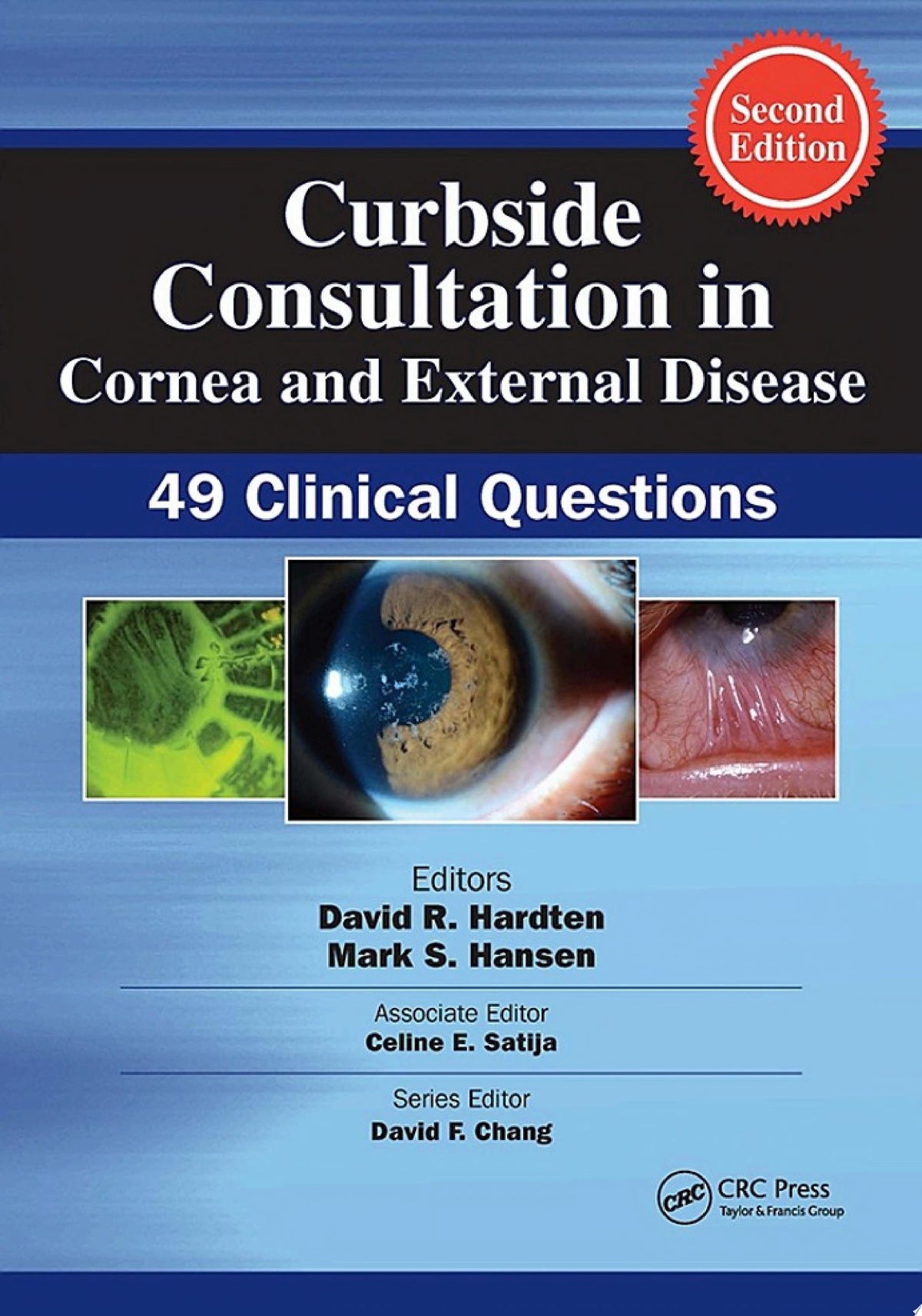 Curbside Consultation in Cornea and External Disease 2nd Edition by Hansen PDF