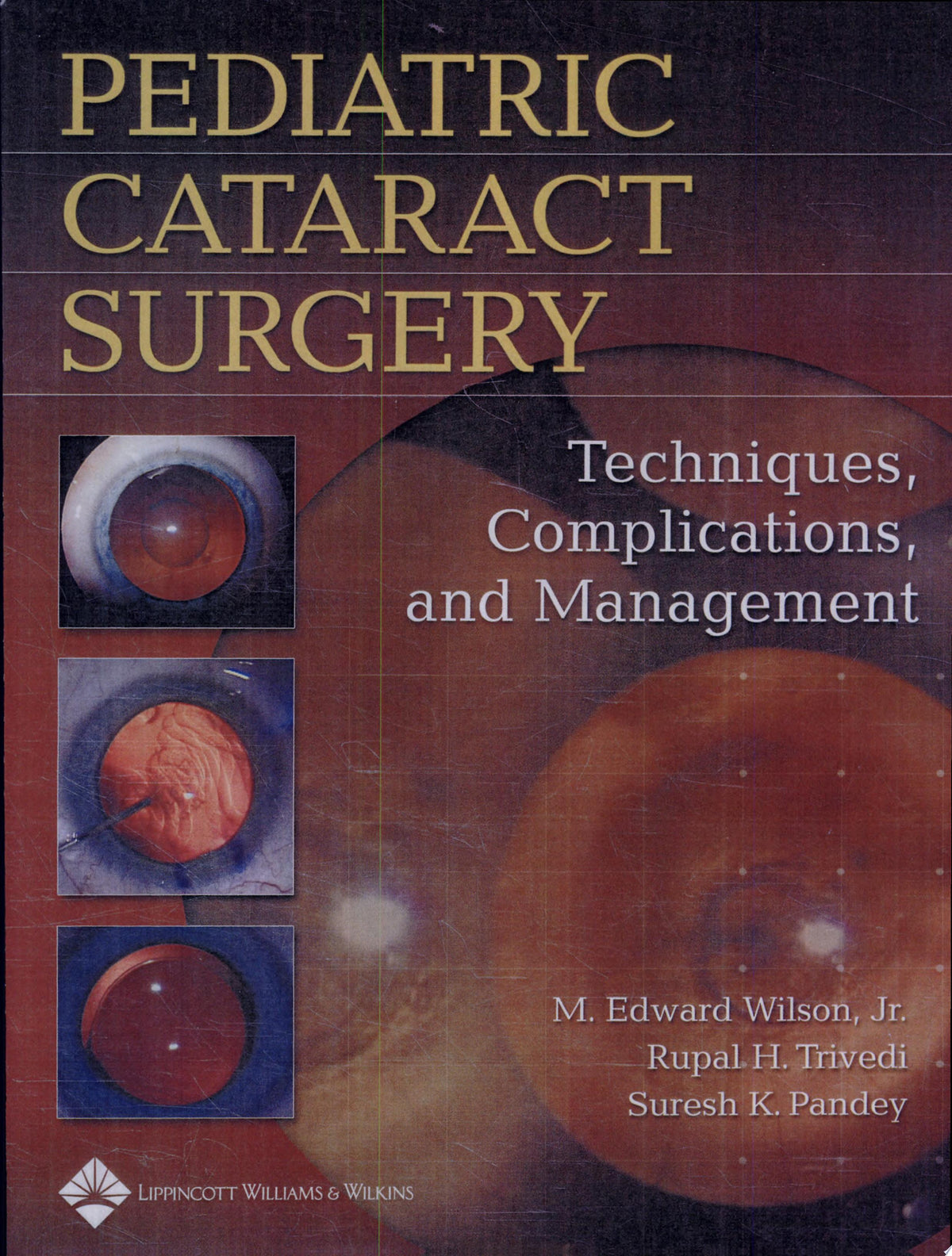 Pediatric Cataract Surgery 1st Edition by Lippincott Williams & Wilkins PDF