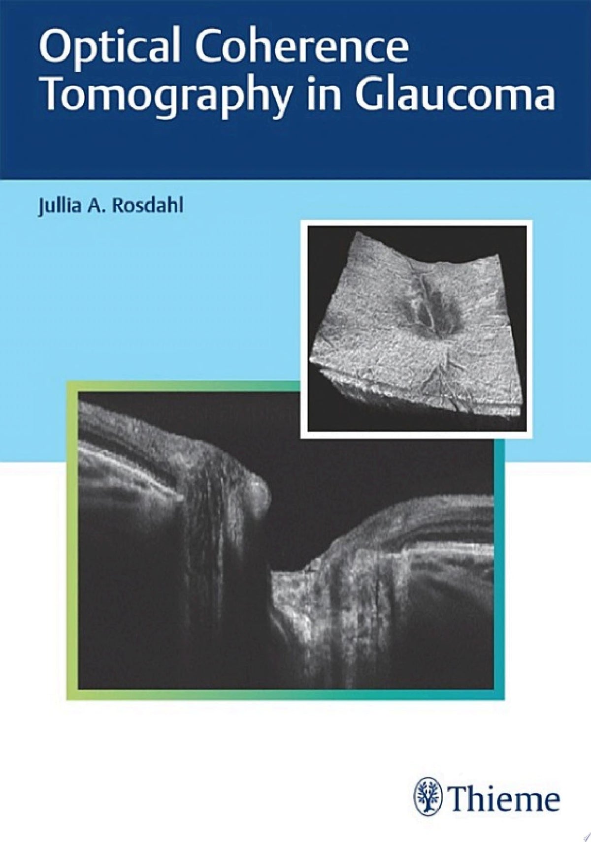 Optical Coherence Tomography in Glaucoma 1st Edition PDF