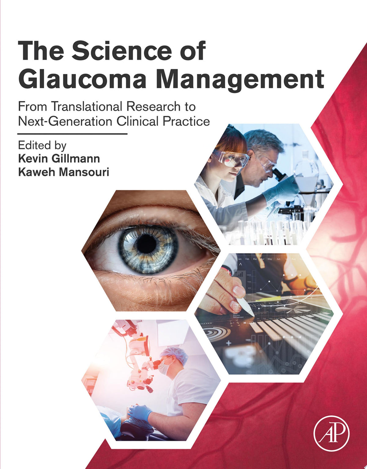 The Science of Glaucoma Management 1st Edition by Gillmann PDF