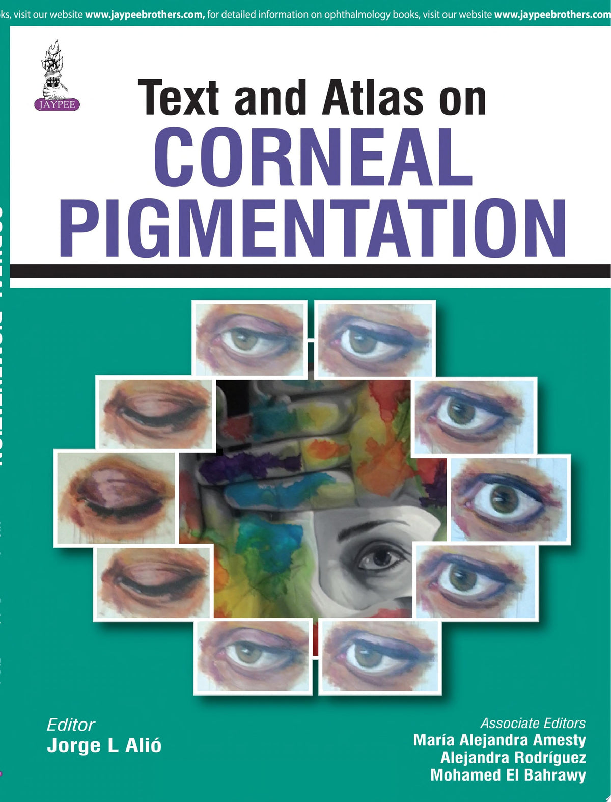 Text and Atlas on Corneal Pigmentation 1st Edition by Alio PDF