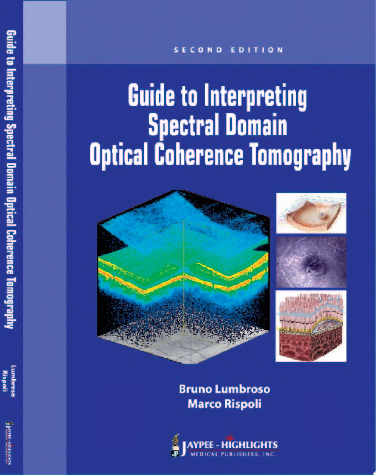 Spectral Domain OCT 1st Edition by Lumbroso PDF