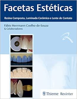 Facetas Estéticas 1st Edition by Thieme PDF