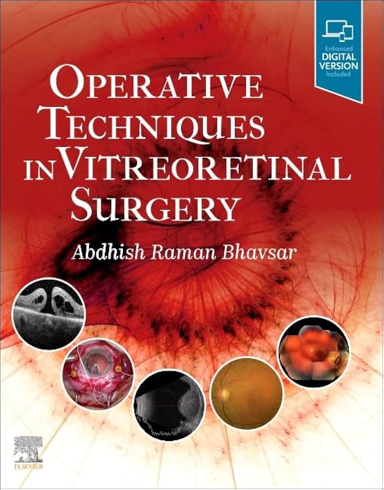 Operative Techniques in Vitreoretinal Surgery 1st Edition by Elsevier PDF