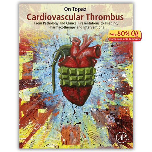 Cardiovascular Thrombus: From Pathology and Clinical Presentations to Imaging, Pharmacotherapy and Interventions (PDF)