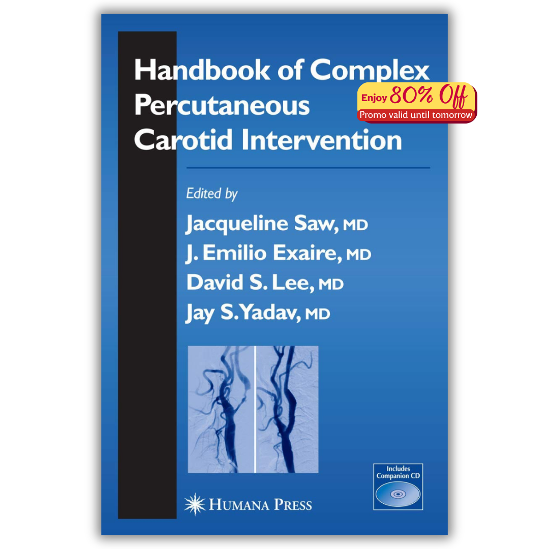 Handbook of Complex Percutaneous Carotid Intervention (PDF)