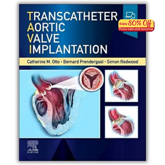Transcatheter Aortic Valve Implantation (Original PDF from Publisher)