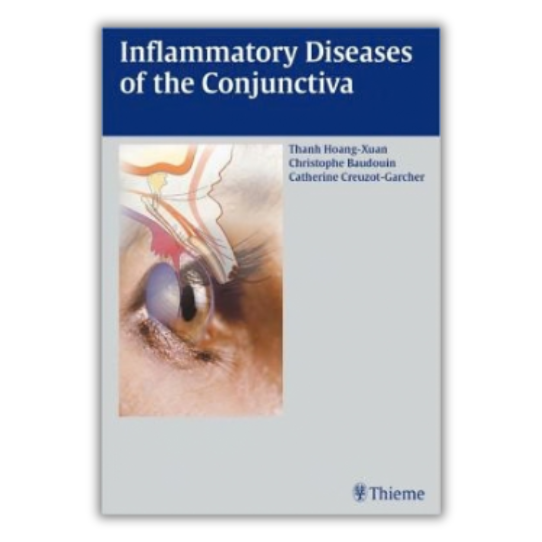 Inflammatory Diseases of the Conjunctivae (PDF)