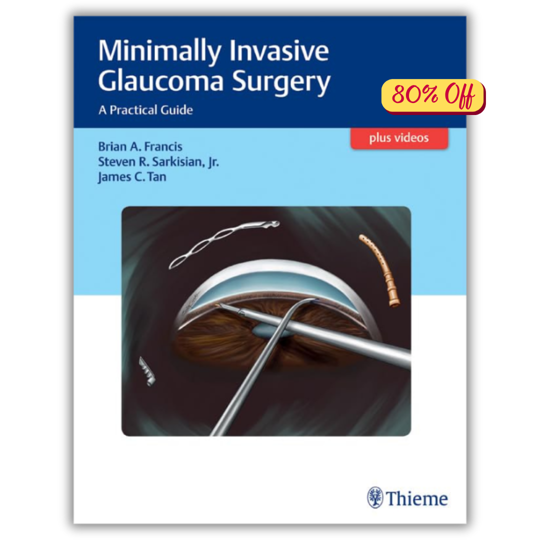 Minimally Invasive Glaucoma Surgery: A Practical Guide (PDF)
