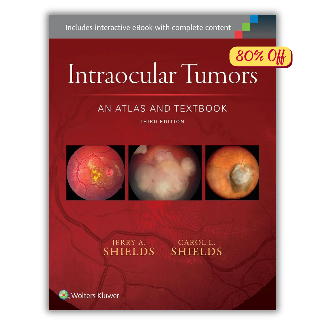 Intraocular Tumors: An Atlas and Textbook (Volume 1) (PDF)