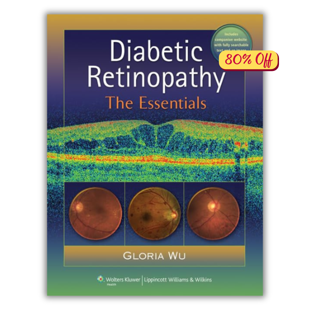 Diabetic Retinopathy: The Essentials (ORIGINAL PDF from Publisher)