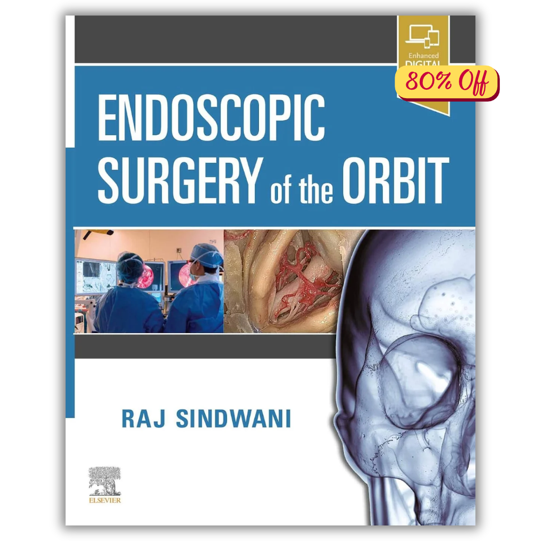 Endoscopic Surgery of the Orbit (PDF)