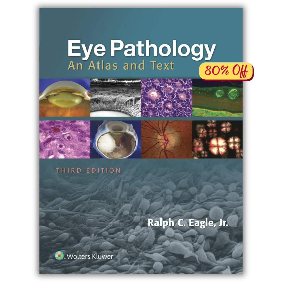 Eye Pathology: An Atlas and Text (ORIGINAL PDF from Publisher)