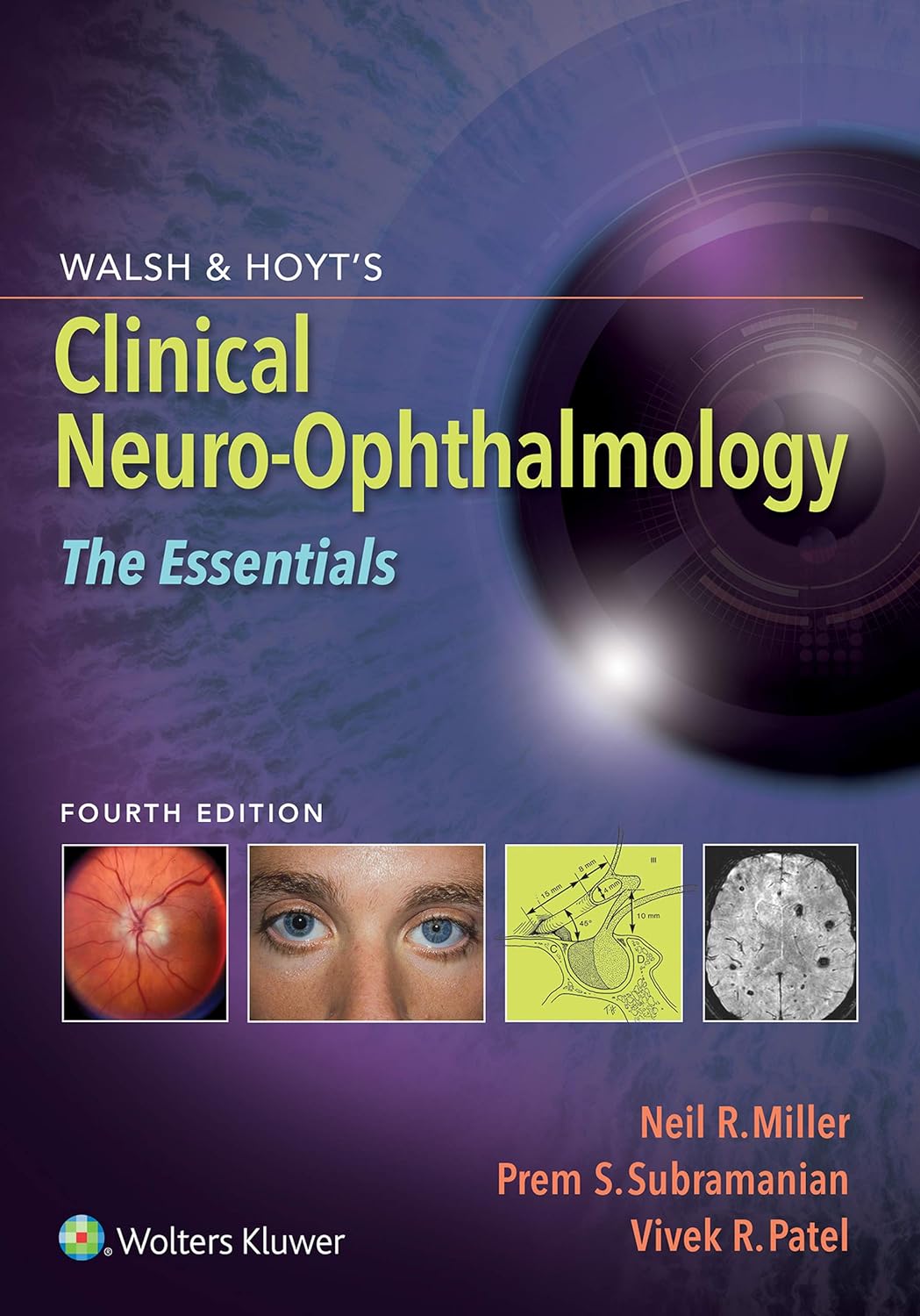 Walsh & Hoyt's Clinical Neuro-Ophthalmology 4th Edition by LWW PDF