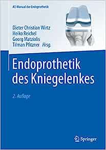 Endoprothetik des Kniegelenkes 2nd Edition PDF