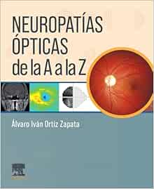 Neuropatías Ópticas de la A a la Z 1st Edition PDF