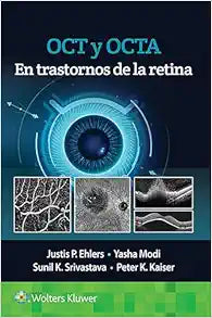 OCT y OCTA en Trastornos de la Retina 1st Edition by Lippincott Williams & Wilkins PDF