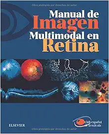 Manual De Imagen Multimodal En Retina 1st Edition by Elsevier PDF