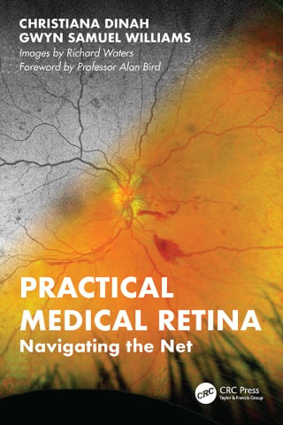 Practical Medical Retina 1st Edition by CRC Press PDF