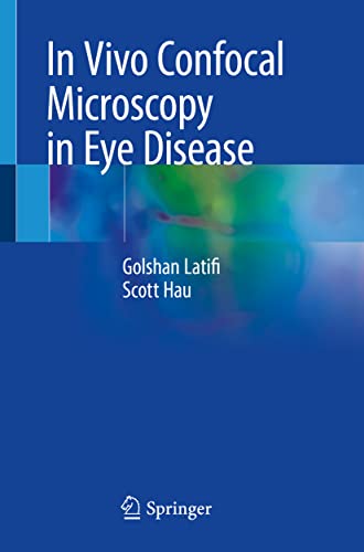 In Vivo Confocal Microscopy in Eye Disease 1st Edition by Springer PDF