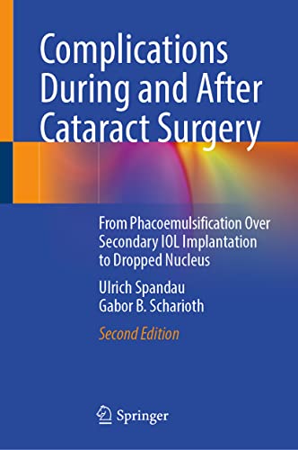 Complications During and After Cataract Surgery 2nd Edition PDF