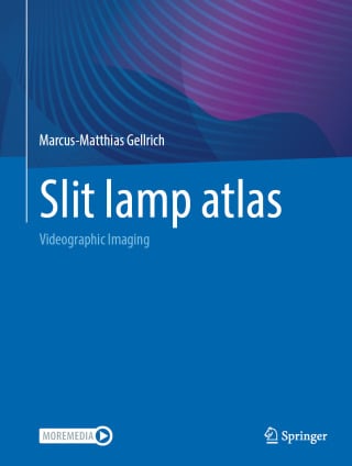 Slit Lamp Atlas 2025th Edition by Springer PDF